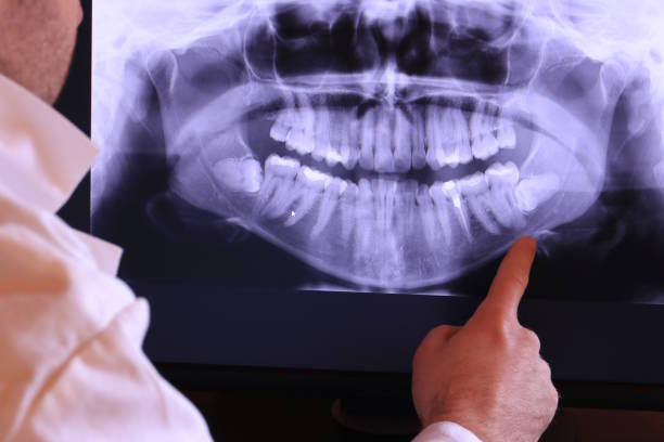 Best 24-Hour Emergency Dental Care in Morgantown, MS
